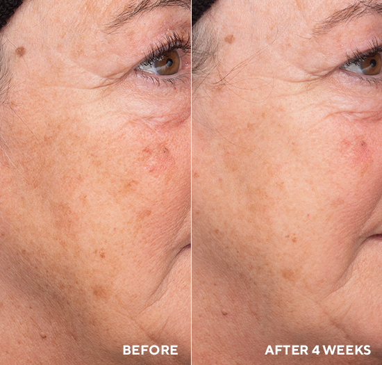 Liquid Resurfacing Solution — Ежедневный несмываемый лосьон-эксфолиант-5