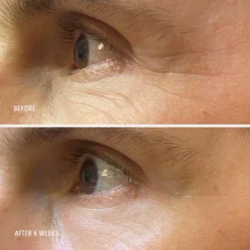 Гиалуроновая кислота: научное обоснование, преимущества и распространенные мифы. Daily Drench before and after